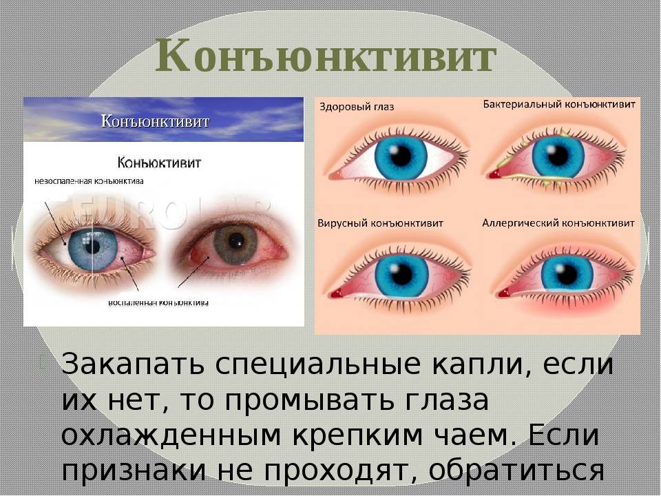 Гибискус и каркаде - в чем разница